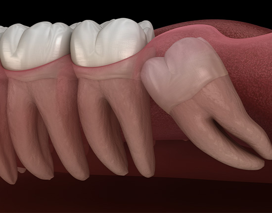 Treatment - Gloucester dental